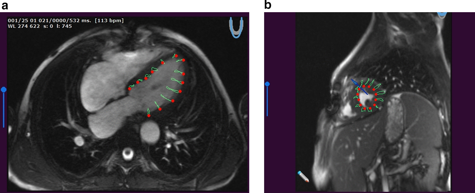 Fig. 2