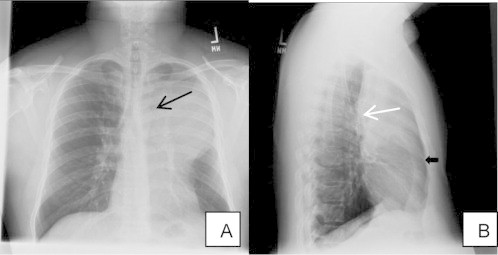 Fig. 1