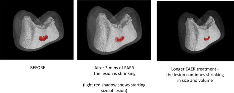 Fig. 9