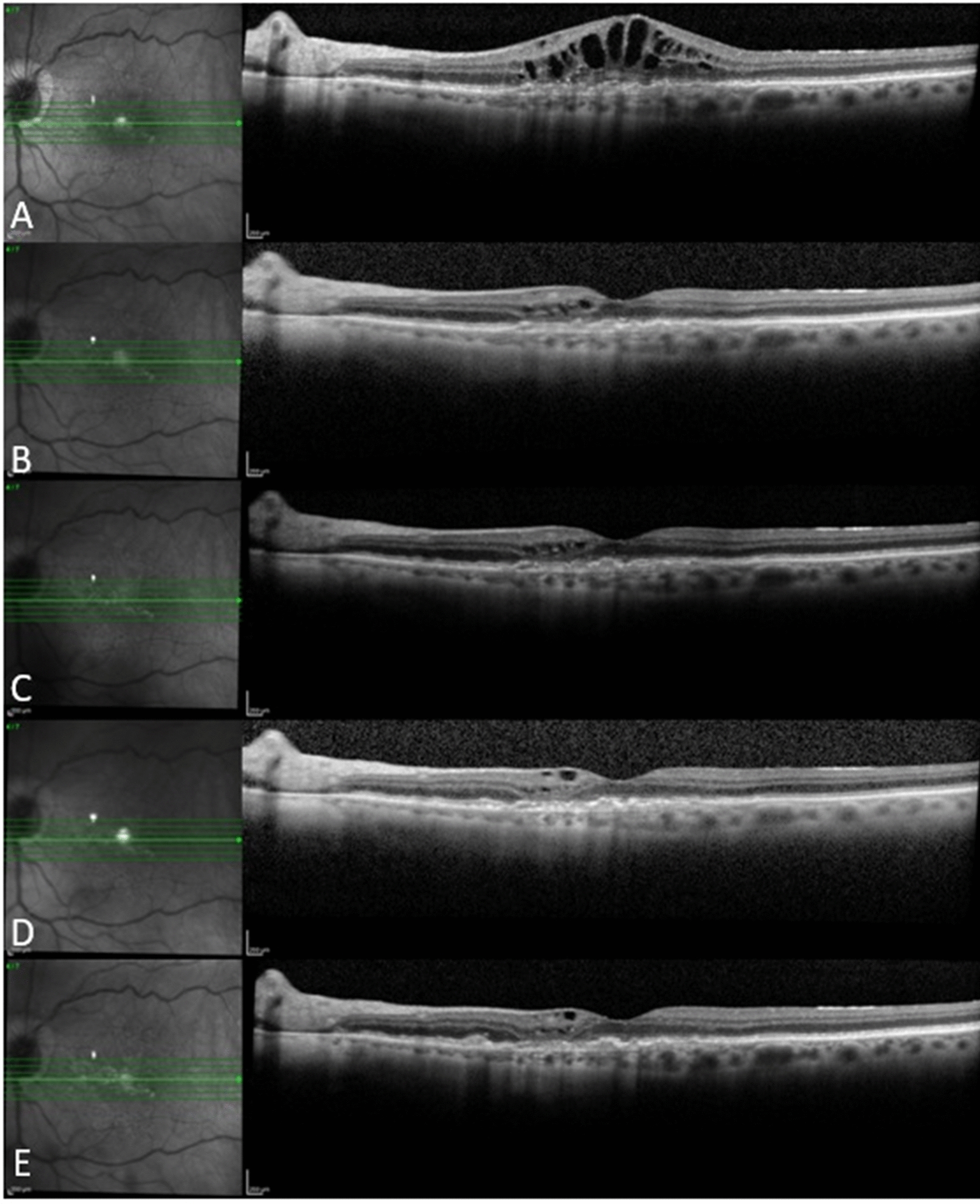 Fig. 4