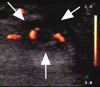 Figure 4:
