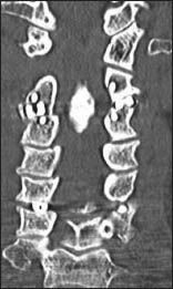 Figure 1d