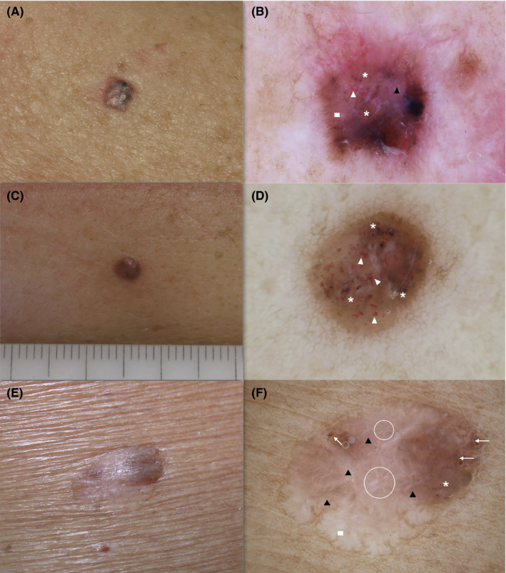 FIGURE 4