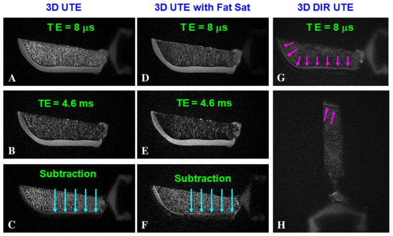 Fig. 11