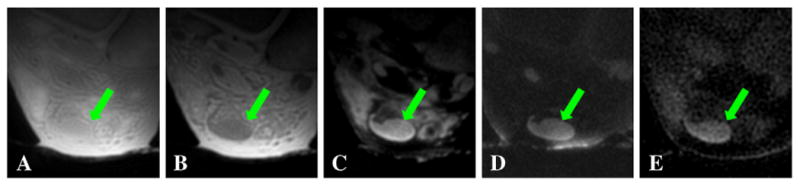 Fig. 13