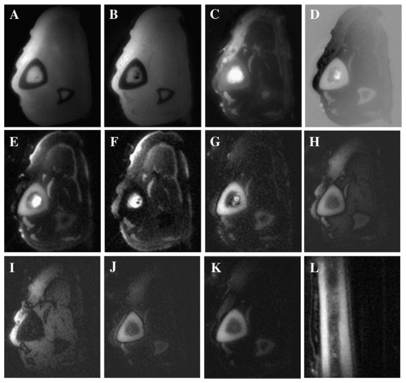 Fig. 12