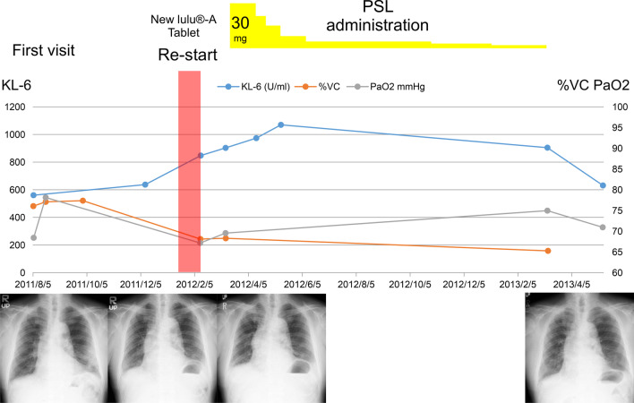 Fig. 4