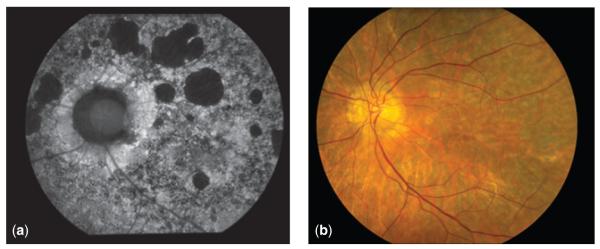 Fig. 3