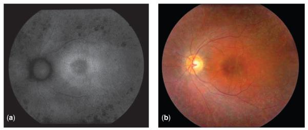 Fig. 4