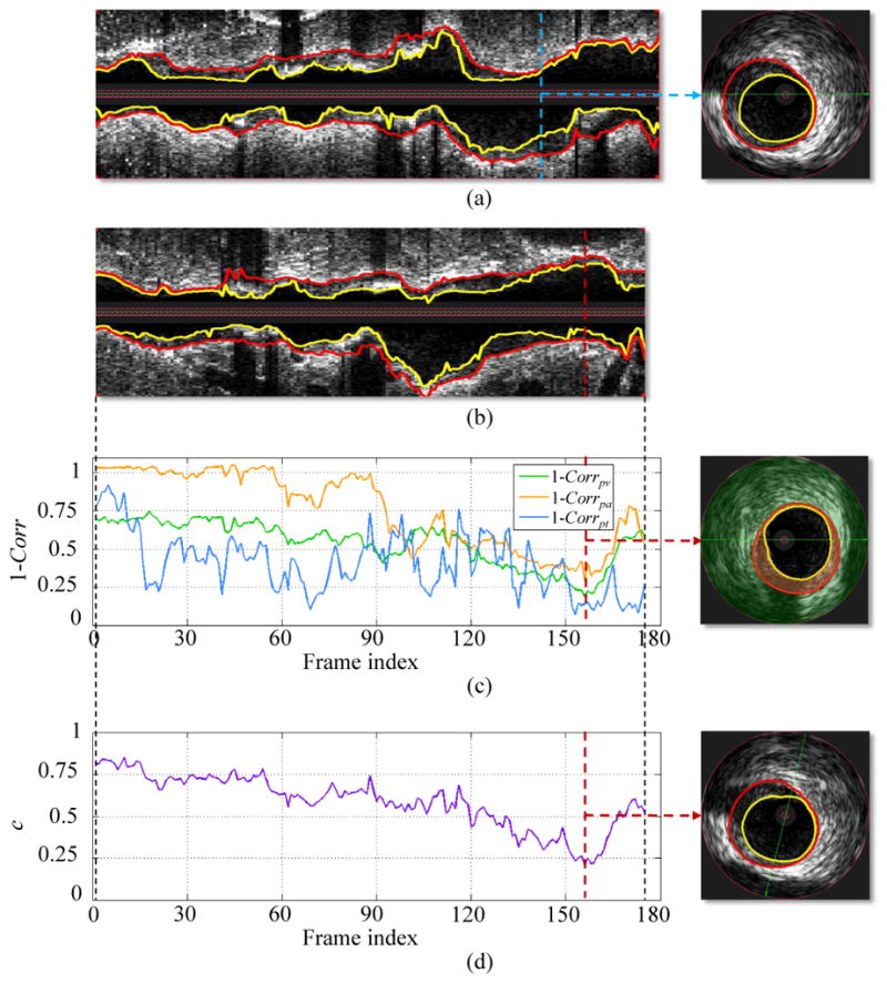 Fig. 4