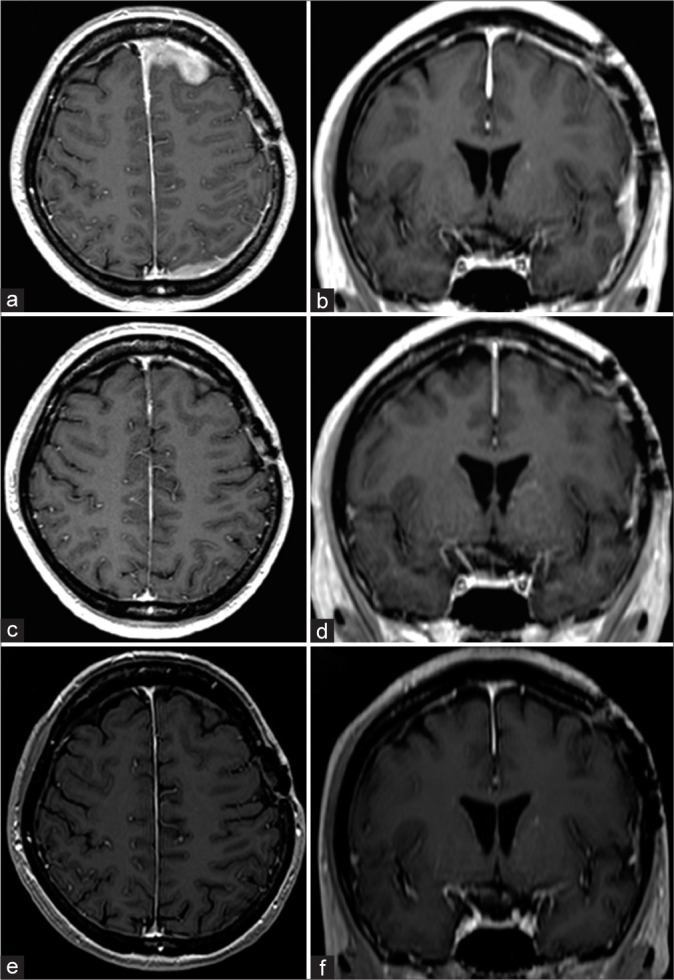 Figure 3: