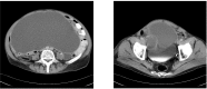 Fig.11,12