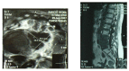 Fig.1,2