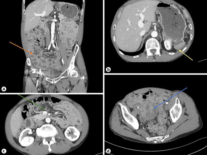 Fig. 1