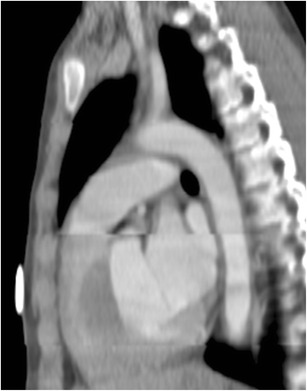 Fig. 14
