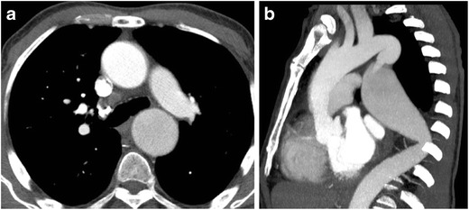 Fig. 15
