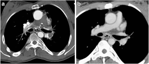 Fig. 12