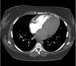 Fig. 9