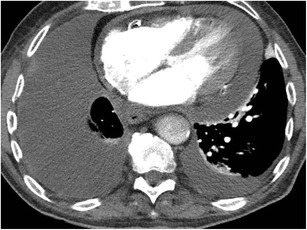 Fig. 11