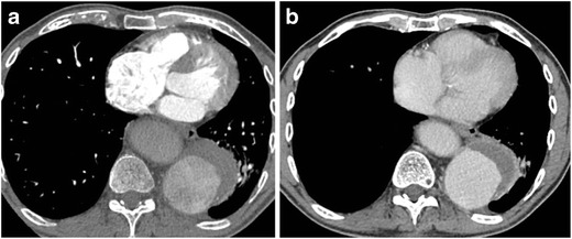 Fig. 16