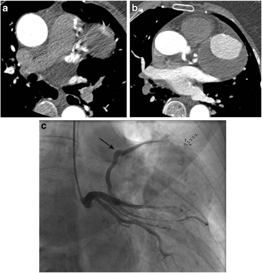 Fig. 13