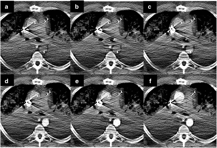 Fig. 17