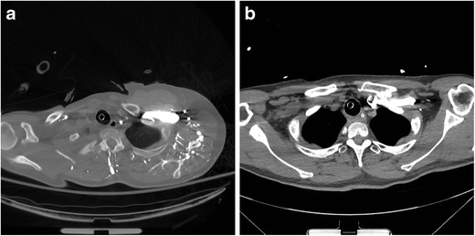 Fig. 5