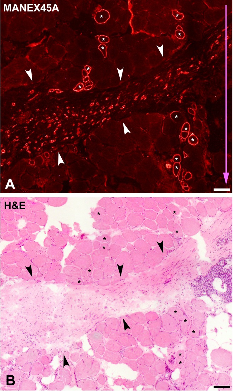 Figure 11.