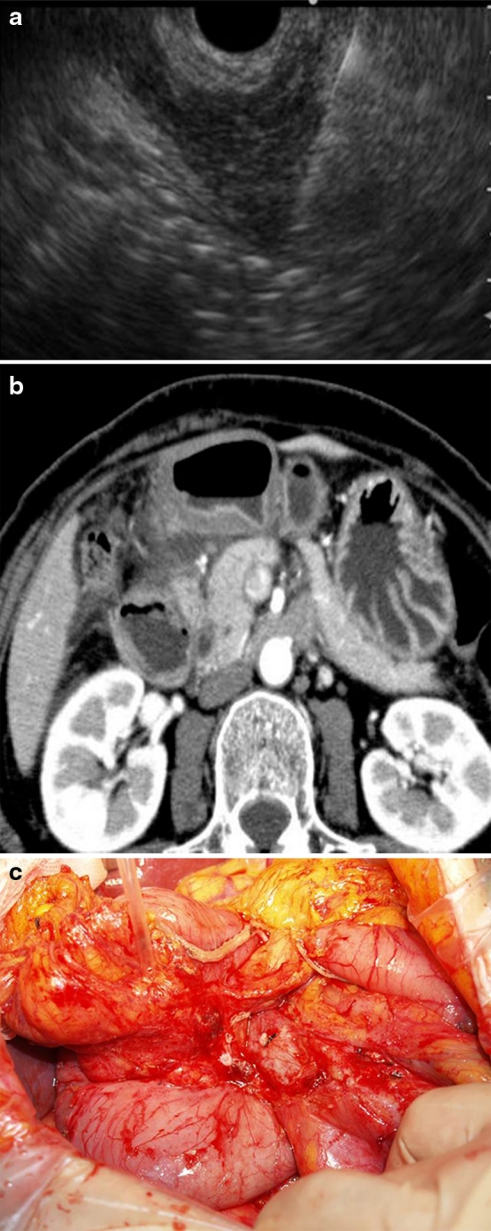 Fig. 2