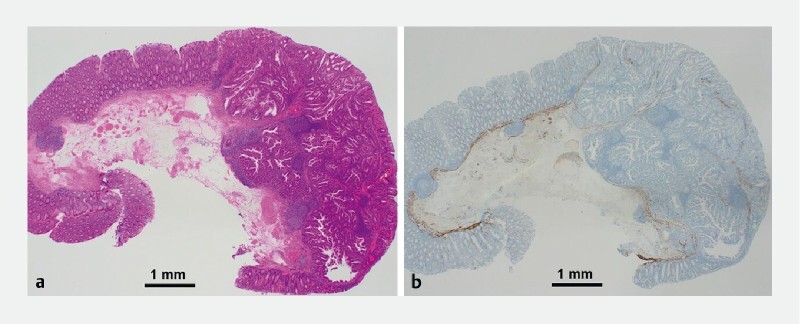 Fig. 4