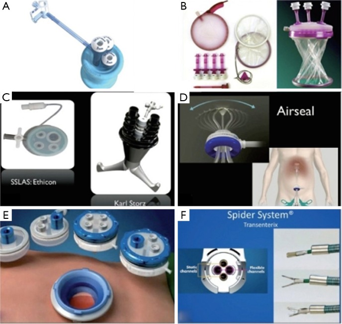 Figure 38