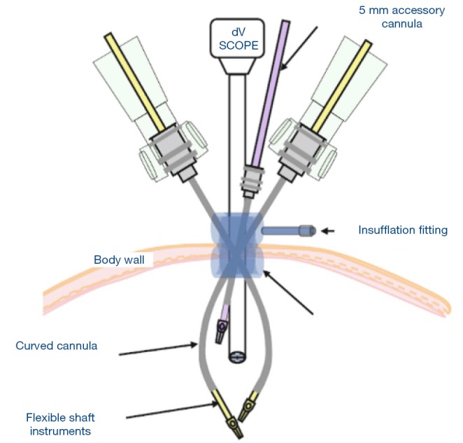 Figure 33