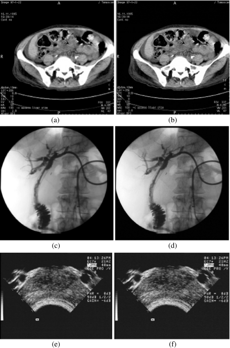 Fig. 4.