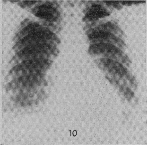 Fig. 10