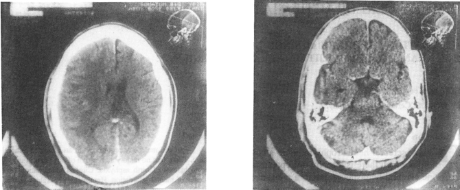 Fig. 2a & b