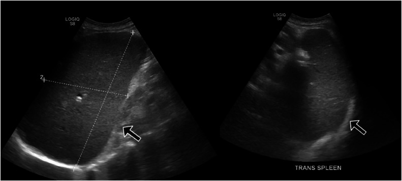 Fig 6: