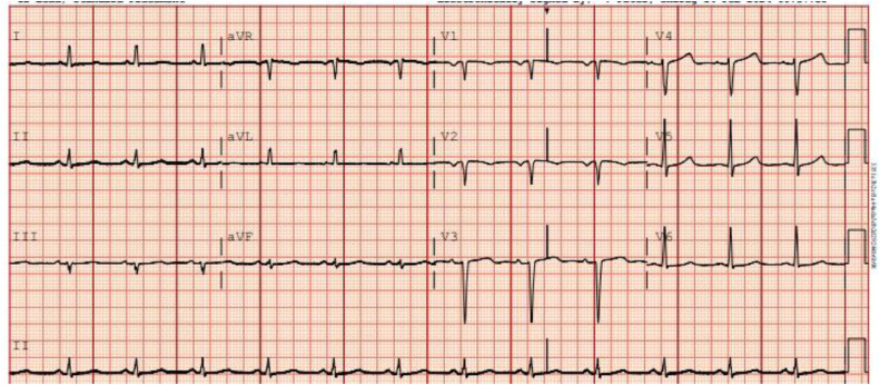 Fig 1: