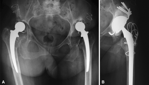 Fig. 3A–B