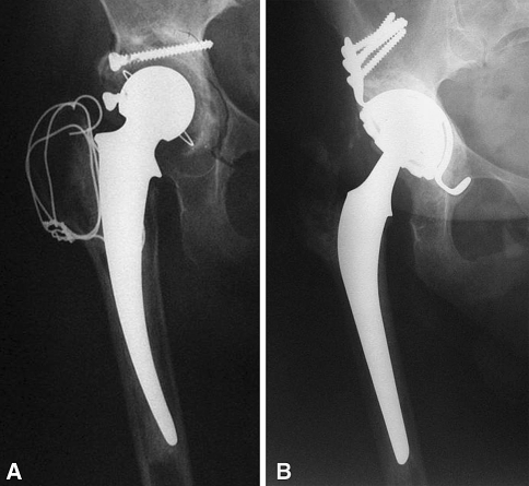 Fig. 2A–B