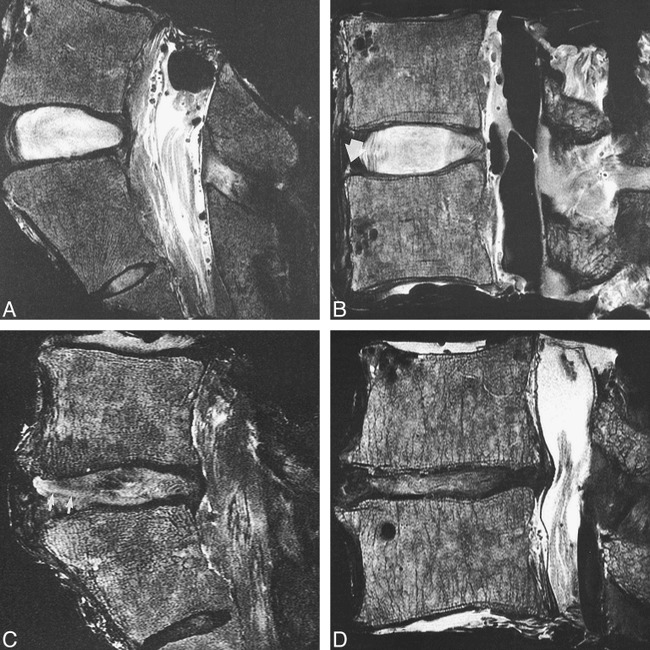 fig 2.