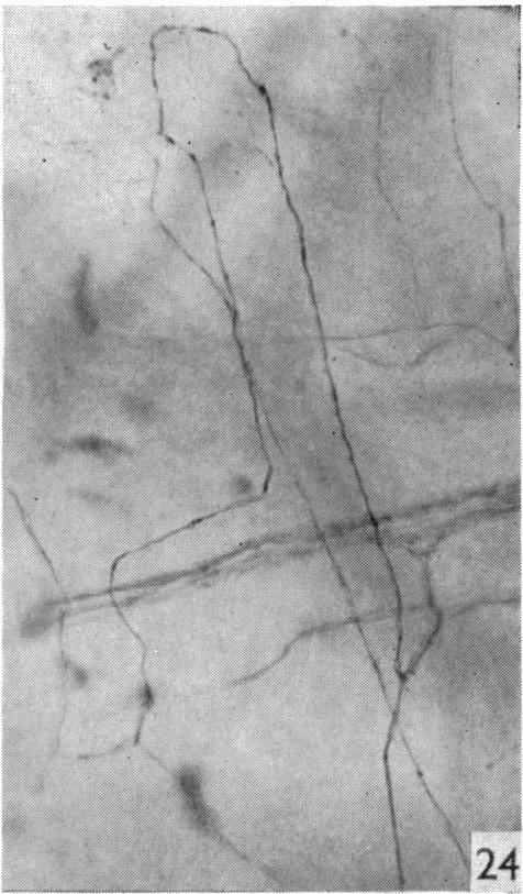 Fig. 24