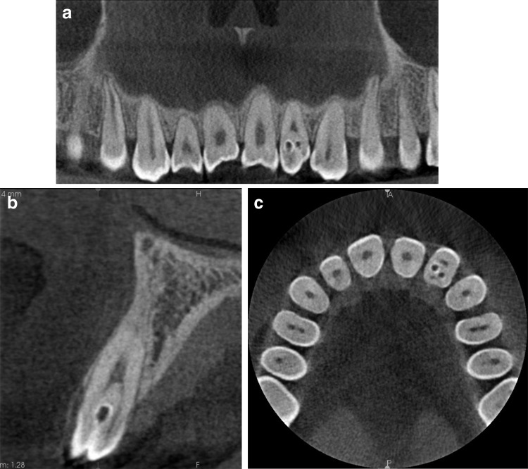 Fig. 1