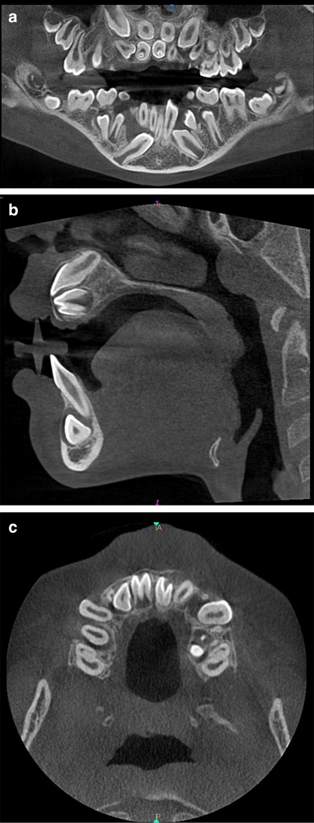 Fig. 3