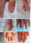 Fig. 1