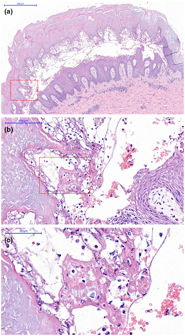 FIGURE 2