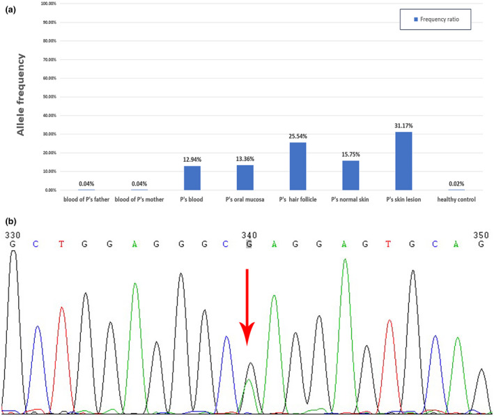 FIGURE 3