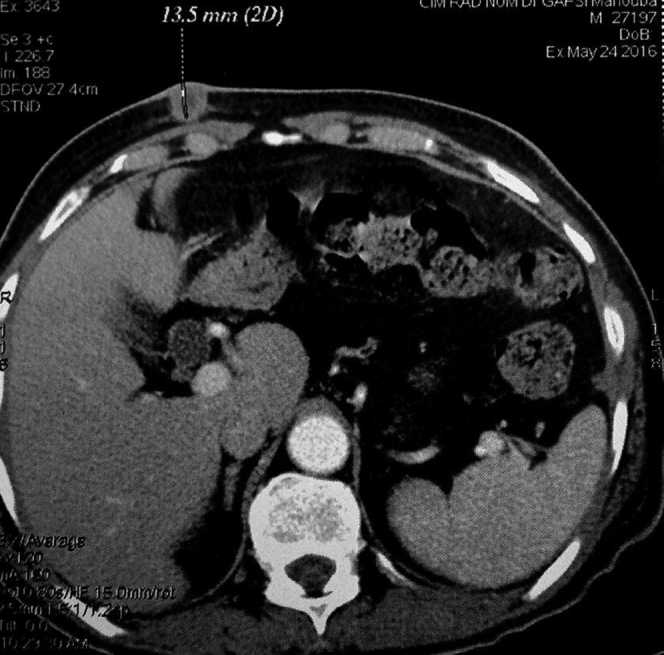Figure 2