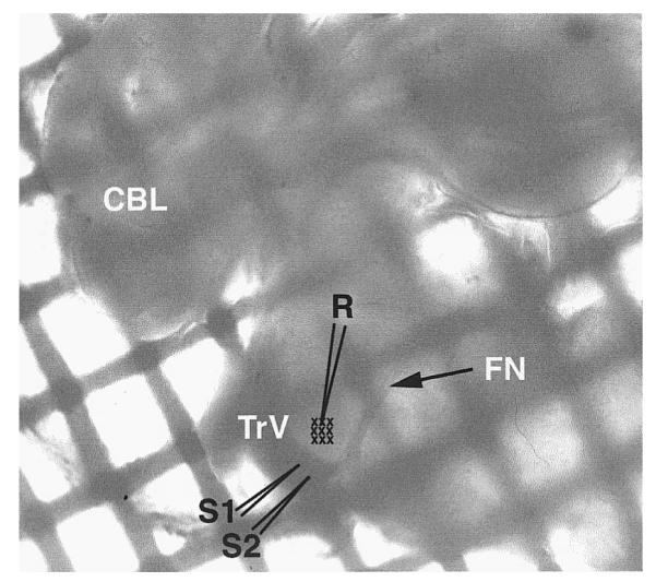 FIG. 1