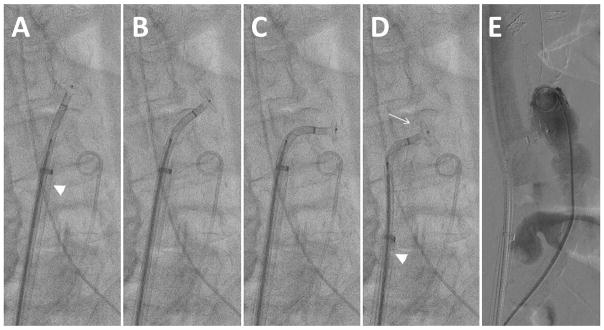 Fig. 11