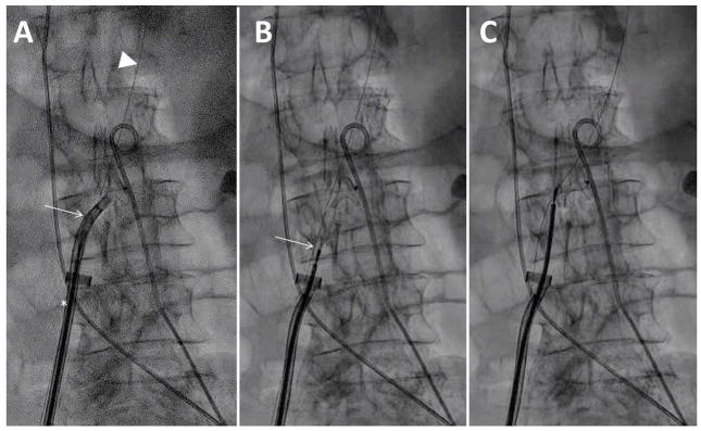 Fig. 12